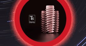Nucleoss İmplant Ege Biyomedikal
